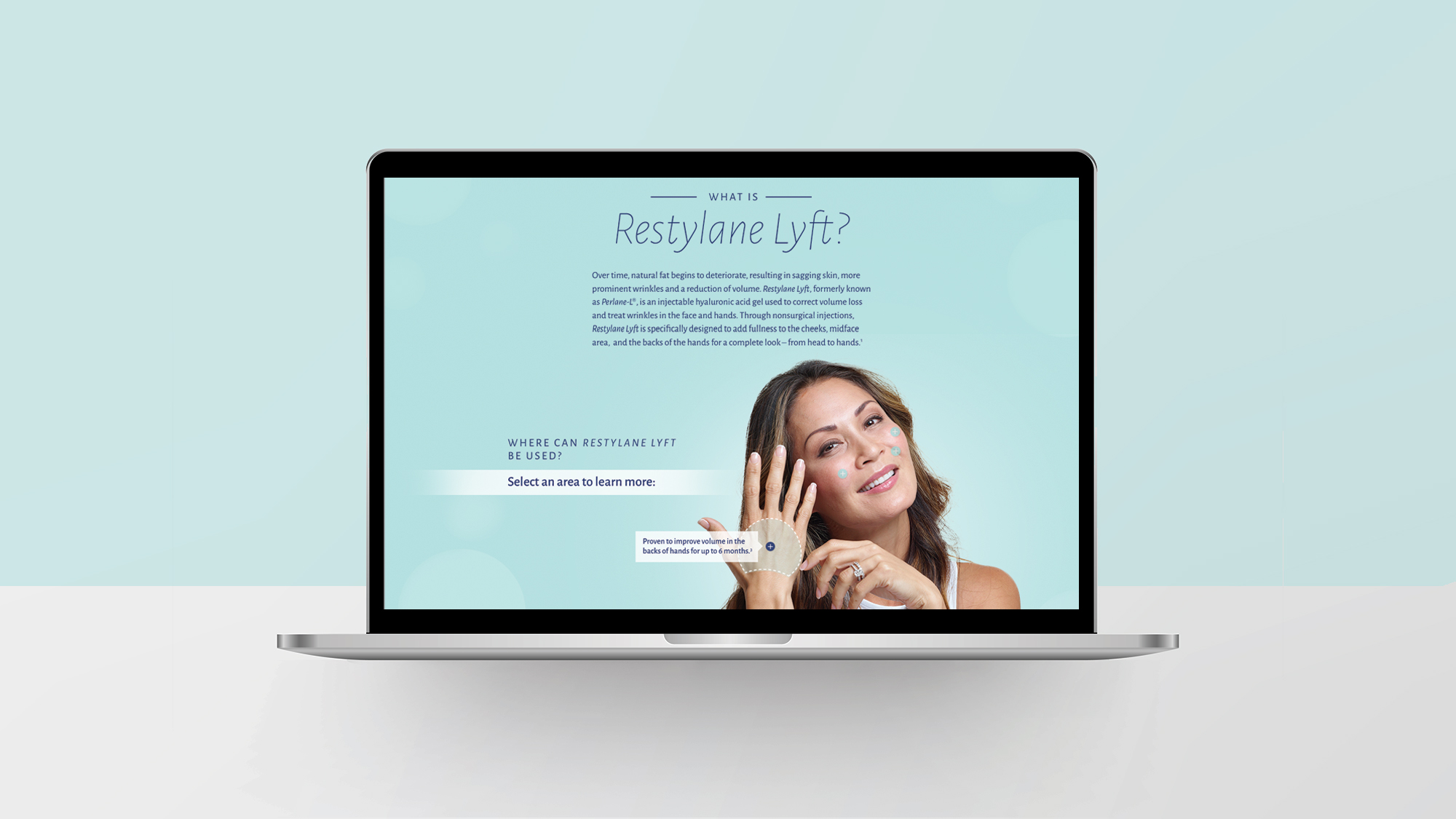 1_sitemock3